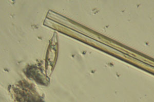 Diatoms