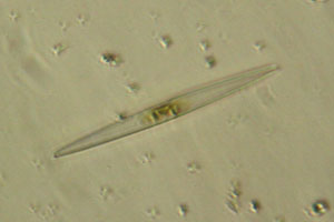Diatom