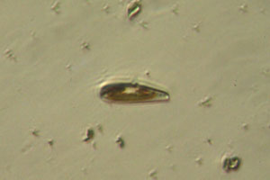 Diatom
