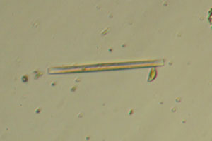 Diatoms