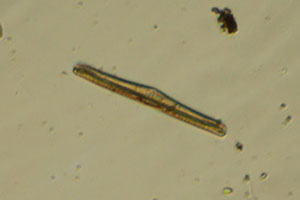 Rhopalodia