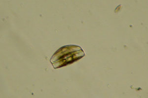Diatom