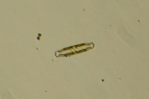 Diatom