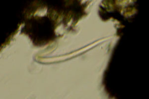 Roundworm