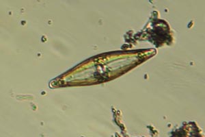 Diatom