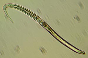Roundworm