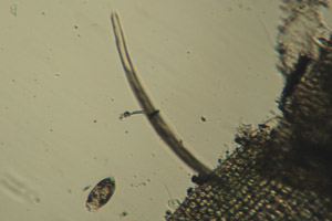 Spirostomum