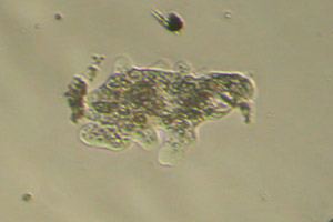 Amoebid