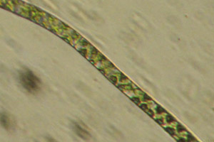 Spirogyra