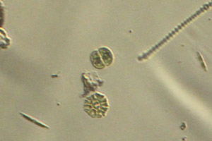 Stauridium, Cosmarium