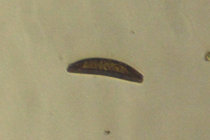 Diatom