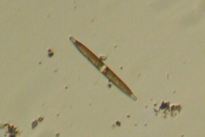 Diatom