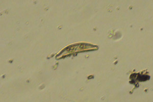 Diatom