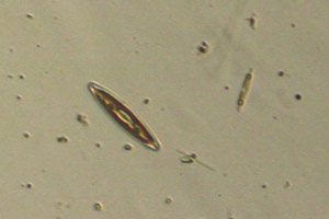 Diatoms