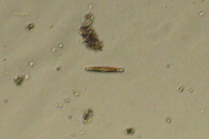 Diatom