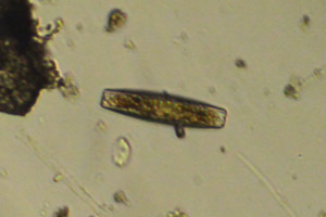 Diatom