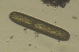 Diatom