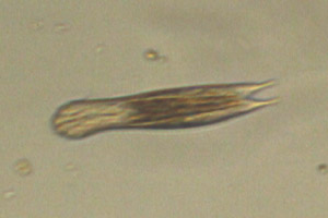 Chaetonotid