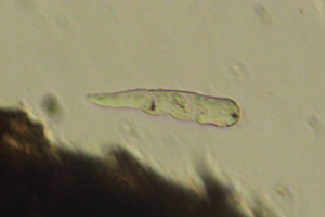 Gnesiotroch larva