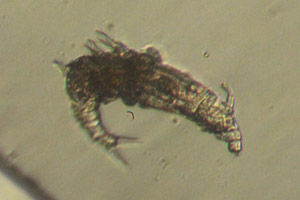 Dissotrocha aculeata
