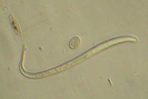Roundworm