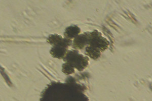 Chlorophyte dividing