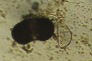 Ciliate