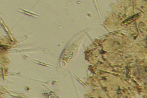 Pleurostome