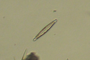 Diatom