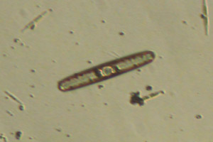 Diatom