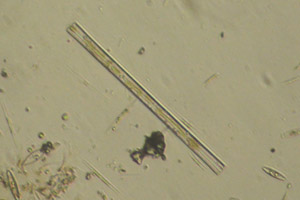 Diatom
