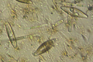 Diatoms