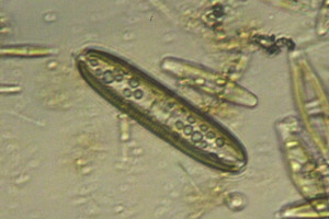 Diatoms