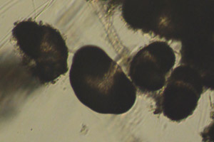 Pine and spruce pollen