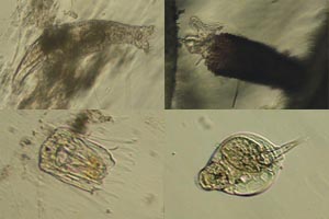 Rotifers