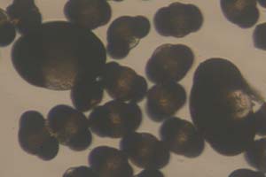 Pollen from mugo pine and spruce