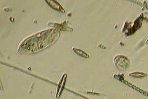 Ciliates