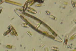 Diatom