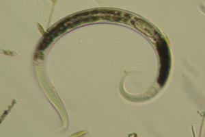 Roundworm