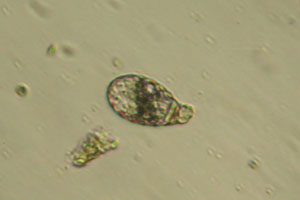 Euglyphida shell
