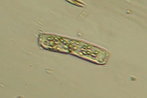 Ciliate