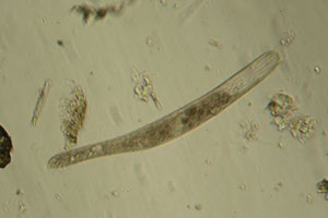 Spirostomum