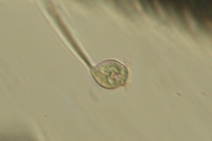 Vorticella