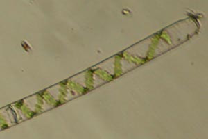 Spirogyra