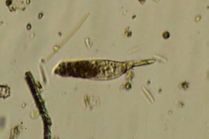 Ciliate