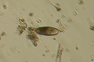 Ciliate