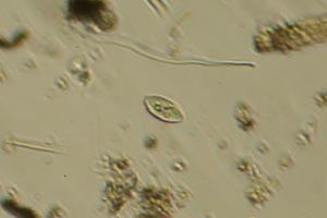Ciliate