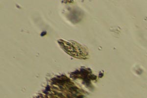 Ciliate