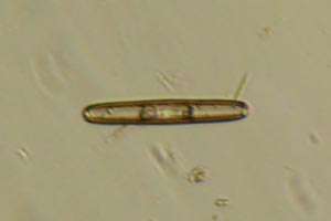 Diatom