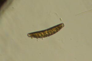 Diatom